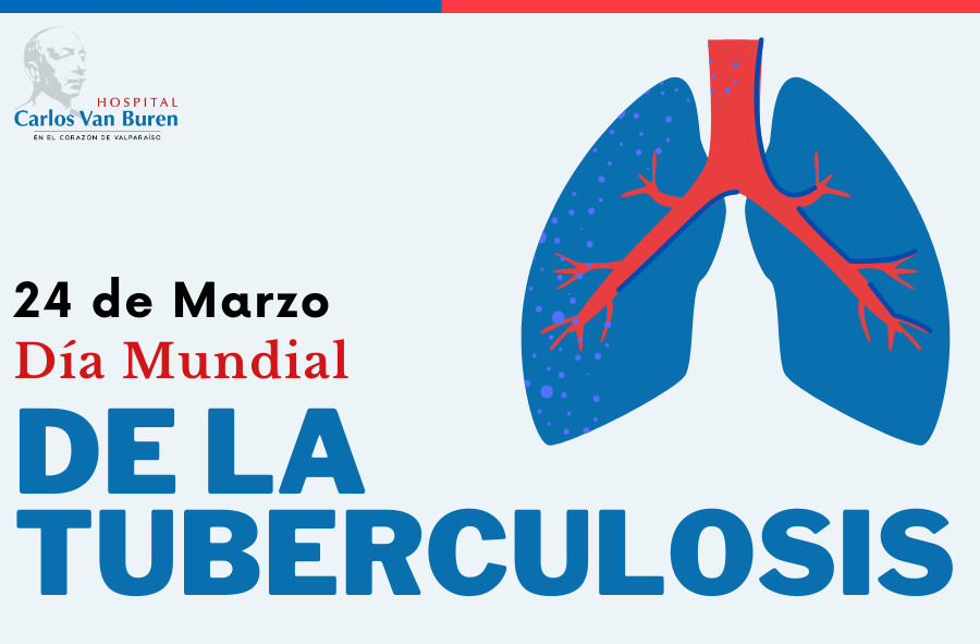 24 DE MARZO Día Mundial de la Tuberculosis Hospital Carlos Van Buren